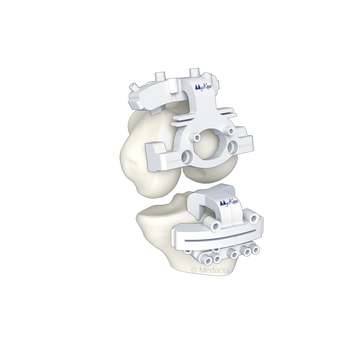 Scanner et planification 3D MyKnee