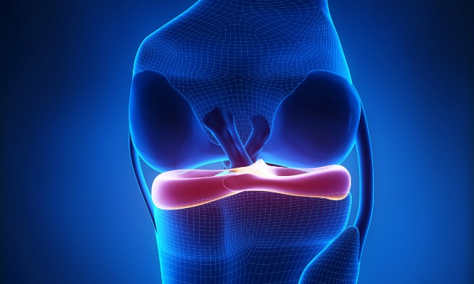 Chirurgie du ménisque